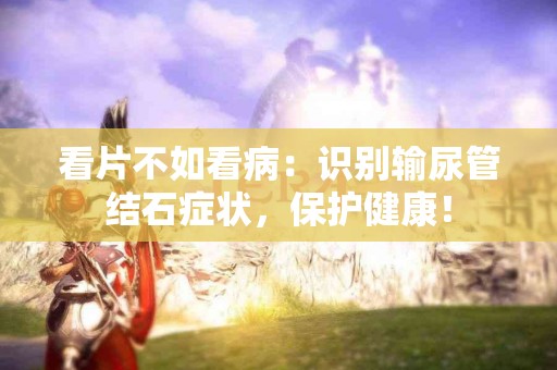 看片不如看病：识别输尿管结石症状，保护健康！