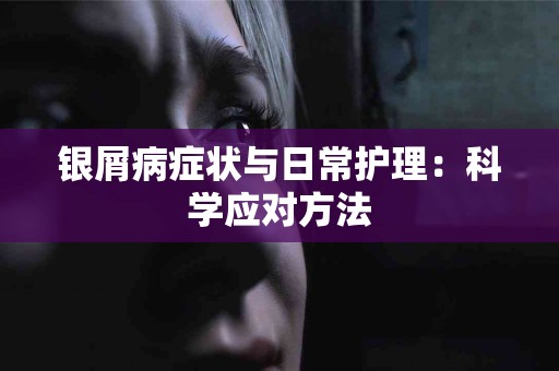 银屑病症状与日常护理：科学应对方法